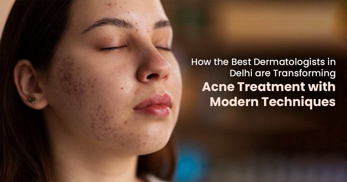 Best Dermatologist in Delhi