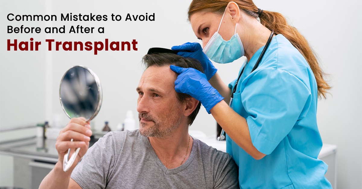 Best Hair Transplant in Gurgaon