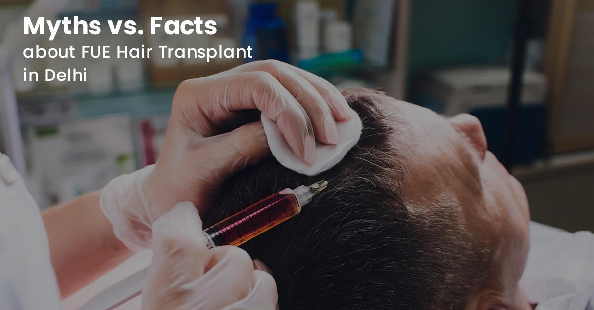 FUE Hair Transplant in Delhi