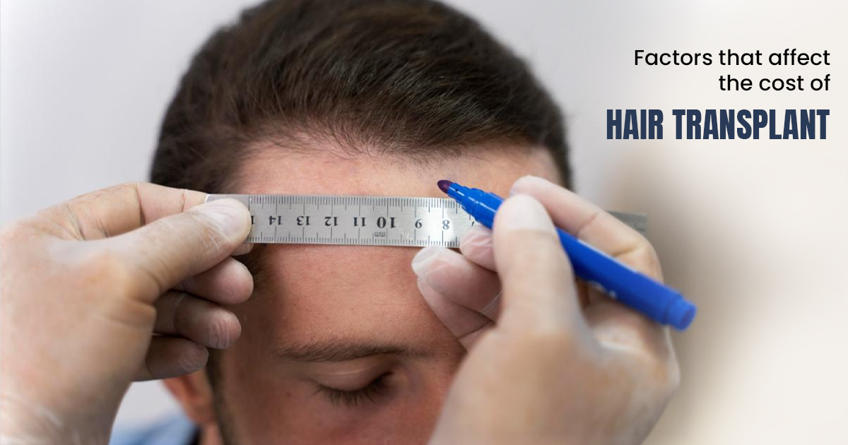 cost of Hair transplant in Delhi