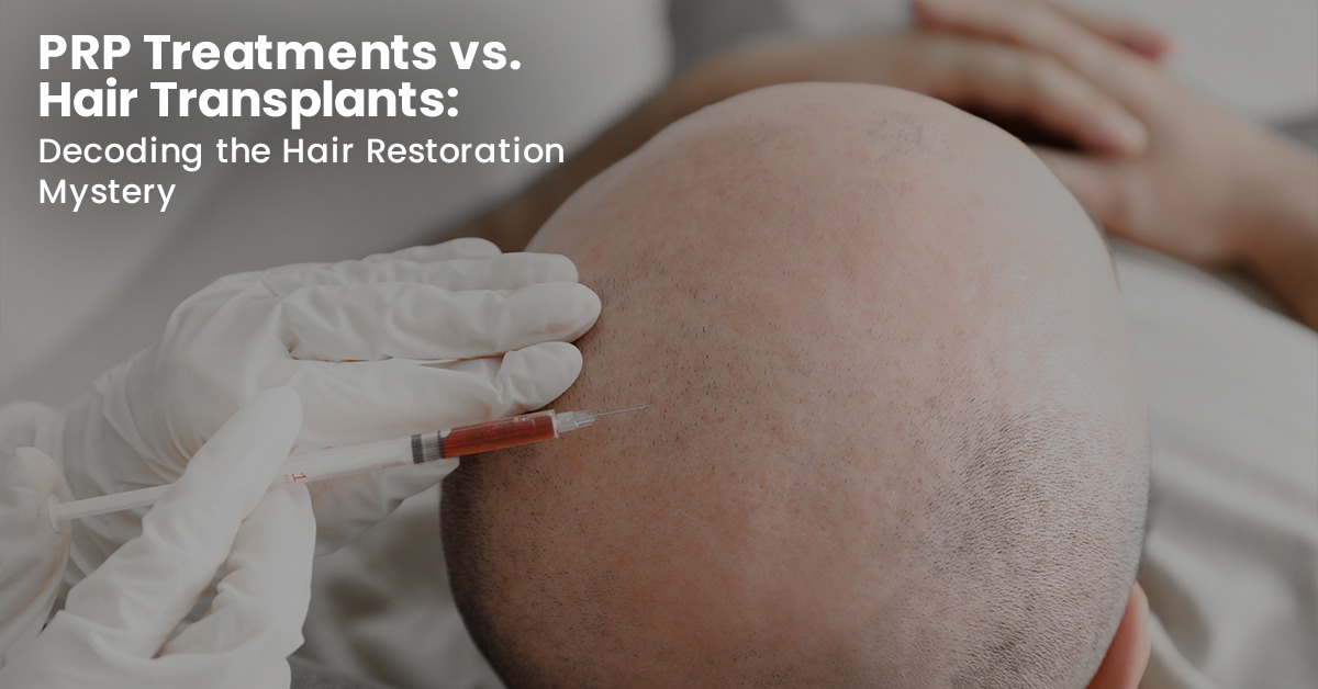 Best Hair Transplant in Delhi